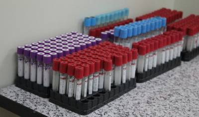 В Тюменской области тестируют на коронавирус членов избиркомов