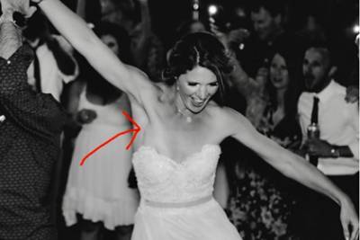 Фото со свадьбы помогло невесте выявить рак