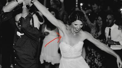 Фото со свадьбы помогло девушке обнаружить у себя рак