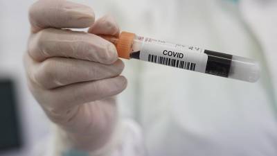 Число выявленных случаев коронавируса в мире превысило 9 млн