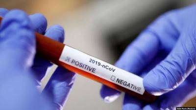 Количество зараженных коронавирусом в Украине превысило 37 тыс., более 1 тыс. случаев - летальные