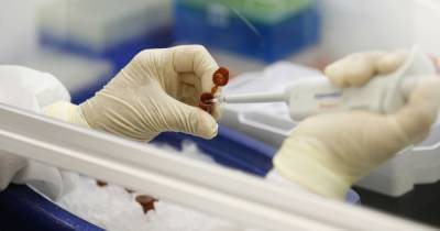 Новый коронавирус может вызывать диабет у здоровых пациентов - ученые