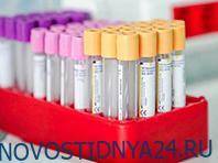 Тестирование на антитела к COVID-19 в России идет полным ходом, заявляют эксперты