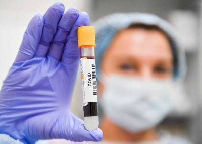 Жители Подмосковья могут сдать тест на антитела к коронавирусу