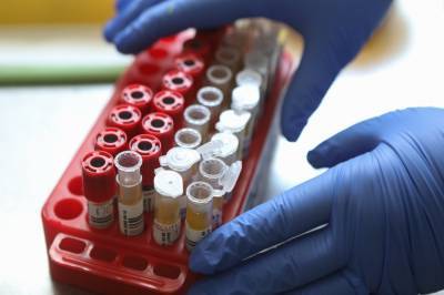 Число проведенных в России тестов на коронавирус превысило 17,5 миллиона