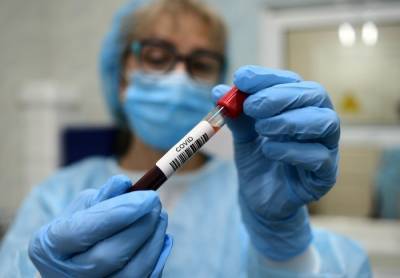 Жители пяти городов Ростовской области смогут пройти бесплатное тестирование на антитела к COVID-19