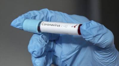 Институт легочных заболеваний перешел на лечение больных коронавирусом