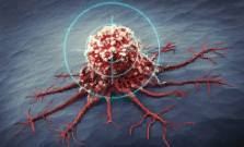 Ученые определили, как наночастицы убивают раковые клетки