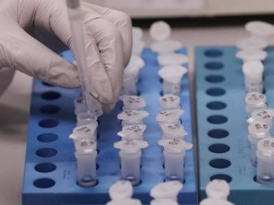 За минувшие сутки на Закарпатье выявлено 85 случаев коронавируса