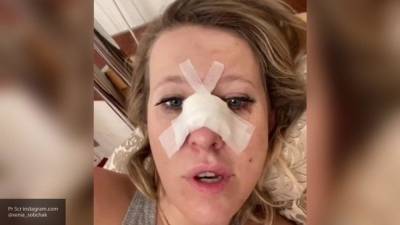 Собчак показала в Instagram последствия перелома носа и сложнейшей операции