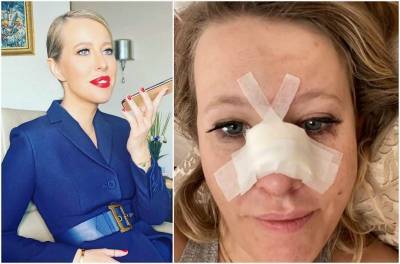 Ксения Собчак попала в больницу с переломом носа и сотрясением мозга