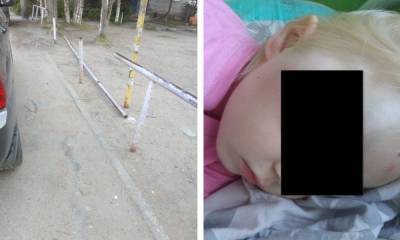 В Карелии железная балка упала на 4-летнюю девочку на детской площадке