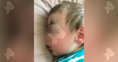 Выброшенная из окна бутылка попала в голову годовалому малышу в Москве