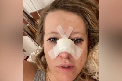 Собчак попала в больницу: у нее сломан нос