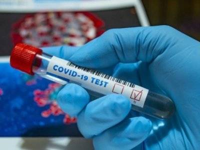 Уже 23909: В Армении за сутки зарегистрировано 662 новых случая заражения коронавирусом