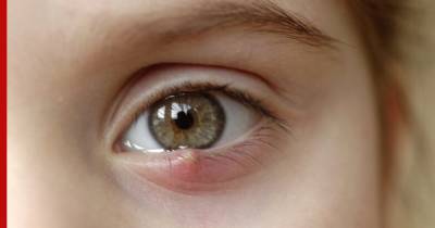 Врачи назвали «глазной» признак диабета, который легко пропустить