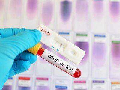 В Арцахе зарегистрирован еще один случай заражения коронавирусом