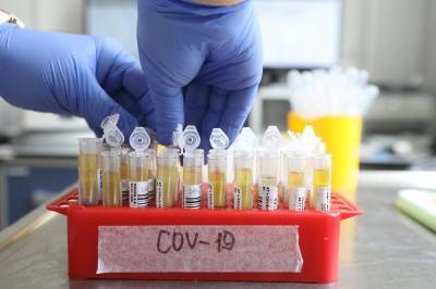 Украина попала в список стран с высокими темпами распространения коронавируса
