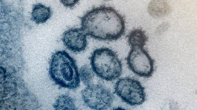 Американские ученые заявили о «зловещих щупальцах» коронавируса