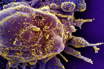 У зараженных коронавирусом клеток нашли «зловещие щупальца»
