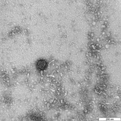 Ученые выявили "зловещие щупальца" у коронавируса