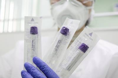 Более 19 миллионов тестов на коронавирус сделали в России