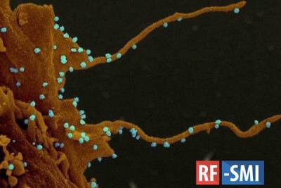 У заражённых коронавирусом клеток появляются "зловещие щупальца"