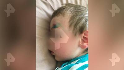 Женщина травмировала ребенка выброшенной из окна бутылкой водки