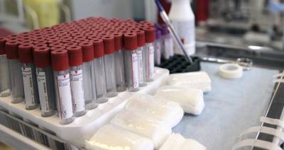 Более 3,4 млрд рублей направят на производство тест-систем на коронавирус
