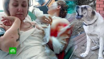 Собака отгрызла руку матери двоих детей в Подмосковье