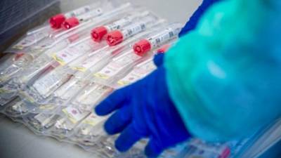 В Баварии бесплатный тест на коронавирус теперь сможет сдать каждый, даже не имя симптомов болезни
