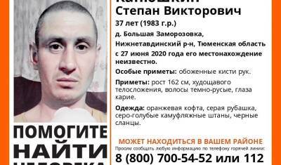 В Тюменской области пропал мужчина с обожженными кистями рук
