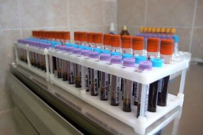 «Вектор» начнёт клинические испытания вакцины от коронавируса