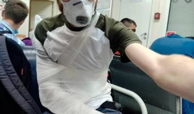 Полицейский сломал руку фотографу на избирательном участке Санкт-Петербурга