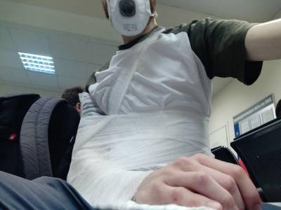 Журналиста «Медиазоны» оперируют после нападения на избирательном участке в Петербурге