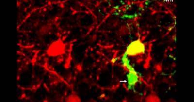 Ученые впервые сняли на видео, как мозг очищается от мертвых нейронов