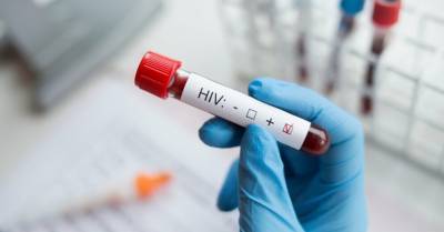 Ассоциация: люди боятся делать анализ и выявляют ВИЧ слишком поздно