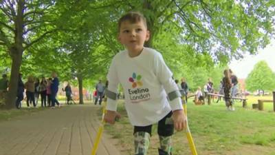 Прошел 10 километров. 5-летний ребенок с протезами ног собрал $1,2 миллиона для больницы