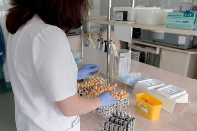 Сколько лабораторных исследований на COVID проведено на Смоленщине с начала пандемии
