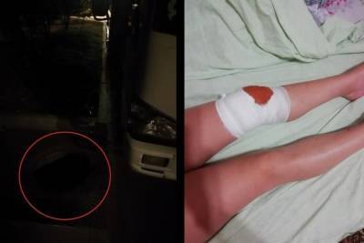 В Краснодаре девушка получила травмы, провалившись в открытый люк