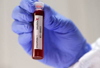 Новые случаи коронавируса выявлены в 12 районах Ленобласти