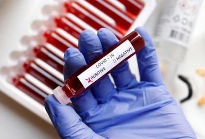 В Ленинградской области выявили 47 новых случаев коронавируса