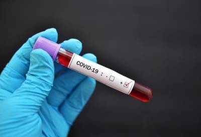 Новые случаи коронавируса выявили в 13 районах Ленобласти