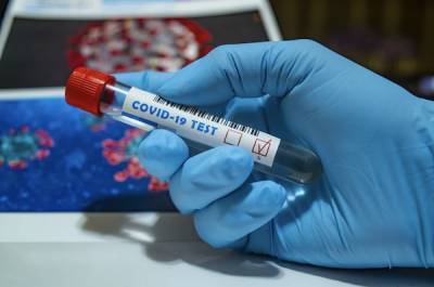 В России провели более 23,2 млн тестов на коронавирус