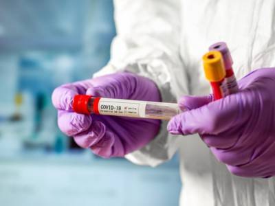 На Закарпатье за сутки зафиксировали 79 случаев коронавируса