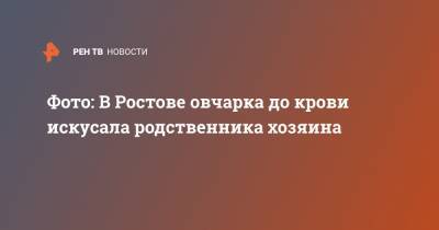 Фото: В Ростове овчарка до крови искусала члена семьи хозяина