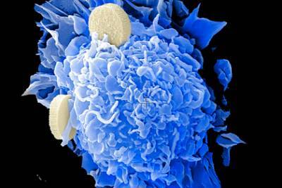 Найдено убивающее раковые клетки полезное вещество