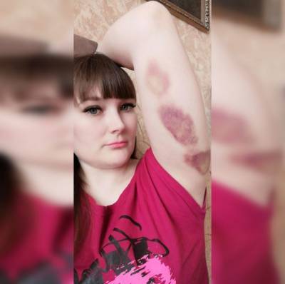 Автомобилистка, обвинившая полицейских в нападении, добилась уголовного дела
