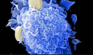 Ученые обгаружили у людей кислоту, которая способна победить раковые клетки