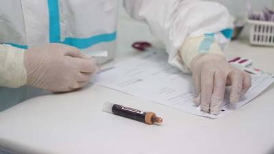 В России зафиксировано 6248 новых случаев заболевания коронавирусом